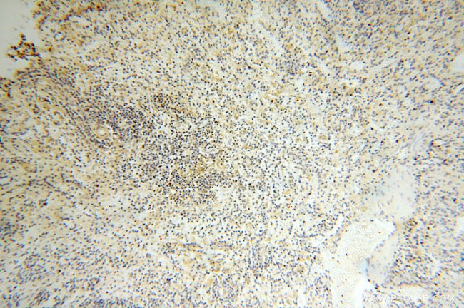 IL15RA Antibody in Immunohistochemistry (Paraffin) (IHC (P))