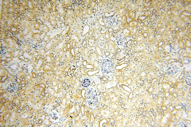 IL15RA Antibody in Immunohistochemistry (Paraffin) (IHC (P))