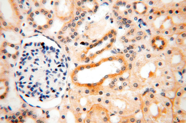 IL15RA Antibody in Immunohistochemistry (Paraffin) (IHC (P))