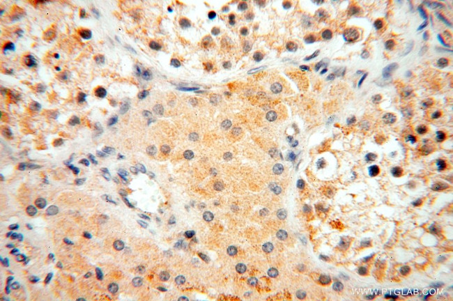 IL15RA Antibody in Immunohistochemistry (Paraffin) (IHC (P))