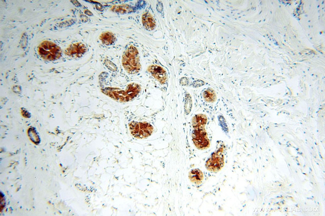 IL15RA Antibody in Immunohistochemistry (Paraffin) (IHC (P))