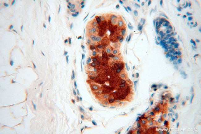 IL15RA Antibody in Immunohistochemistry (Paraffin) (IHC (P))