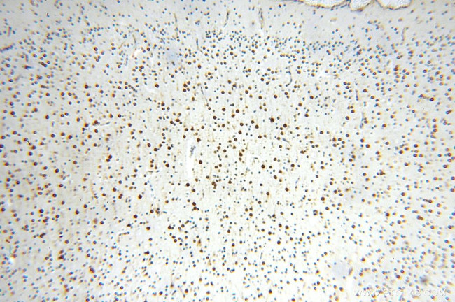 IL15RA Antibody in Immunohistochemistry (Paraffin) (IHC (P))