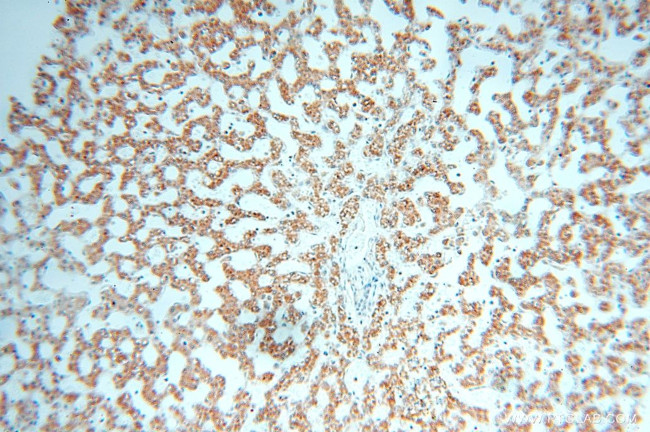 IL15RA Antibody in Immunohistochemistry (Paraffin) (IHC (P))