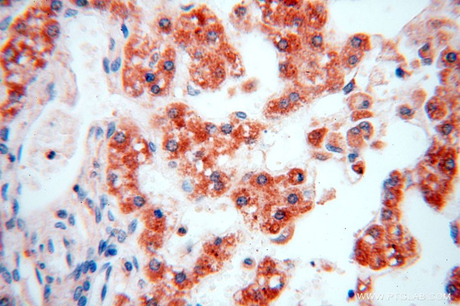 IL15RA Antibody in Immunohistochemistry (Paraffin) (IHC (P))