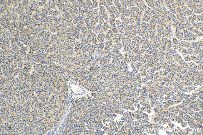 IL15RA Antibody in Immunohistochemistry (Paraffin) (IHC (P))