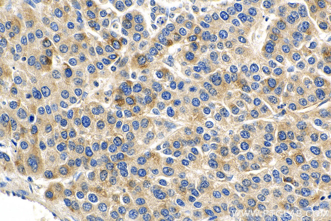 IL15RA Antibody in Immunohistochemistry (Paraffin) (IHC (P))