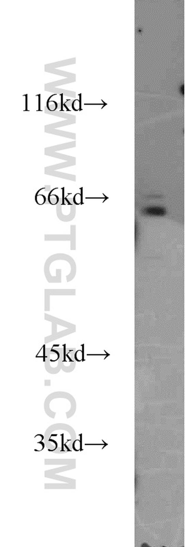 IL15RA Antibody in Western Blot (WB)