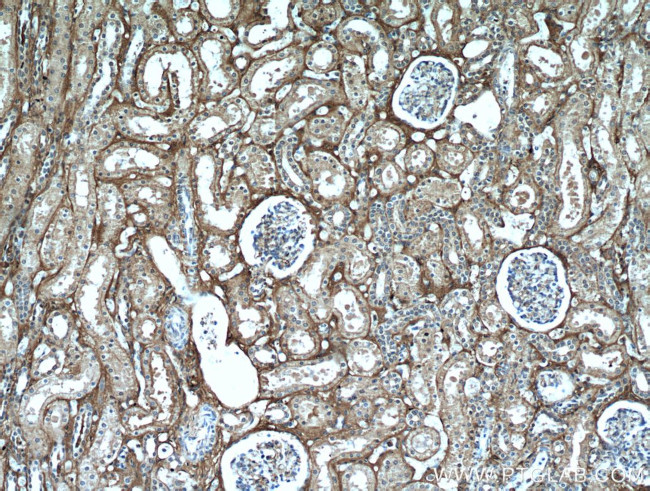 Fibrinogen beta chain Antibody in Immunohistochemistry (Paraffin) (IHC (P))