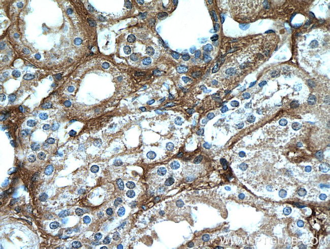 Fibrinogen beta chain Antibody in Immunohistochemistry (Paraffin) (IHC (P))