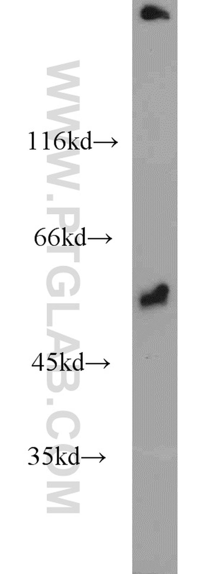 Fibrinogen beta chain Antibody in Western Blot (WB)