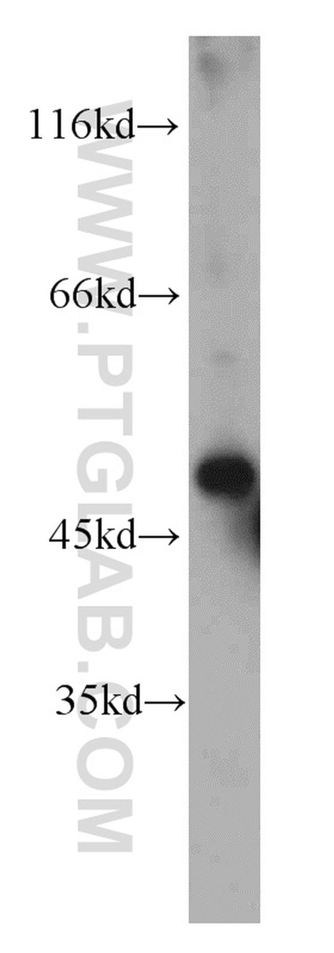 Fibrinogen beta chain Antibody in Western Blot (WB)