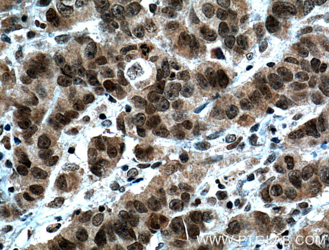 SPOP Antibody in Immunohistochemistry (Paraffin) (IHC (P))