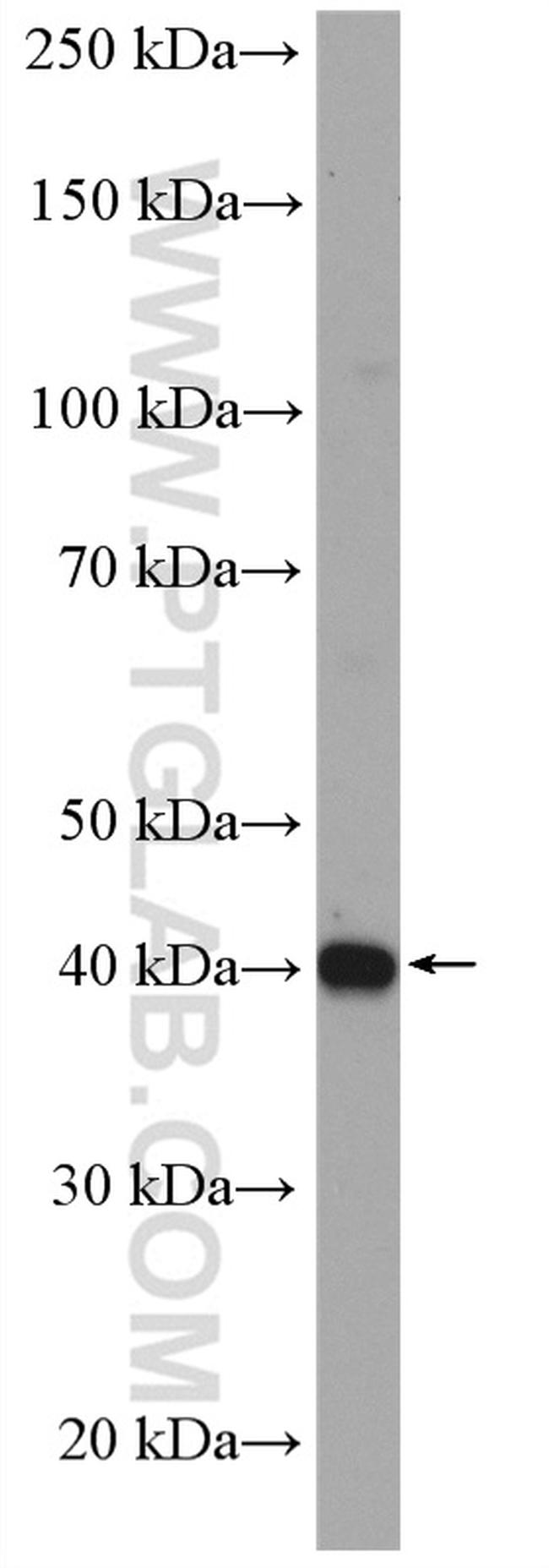 SPOP Antibody in Western Blot (WB)