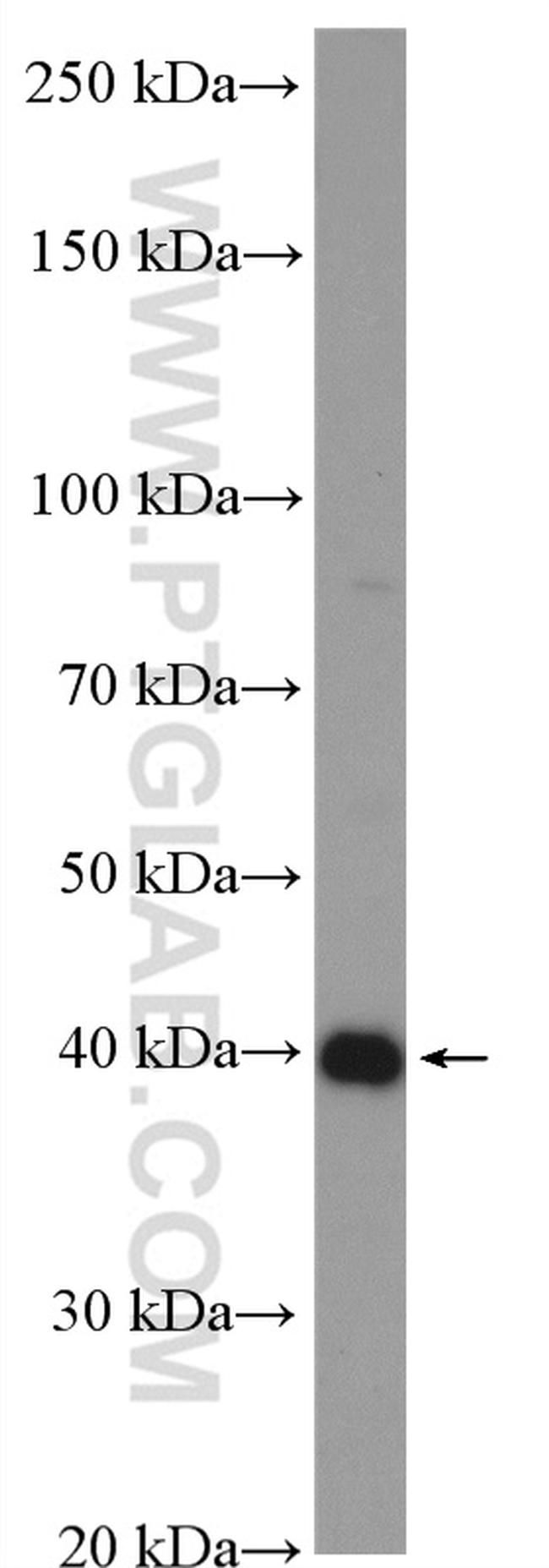 SPOP Antibody in Western Blot (WB)