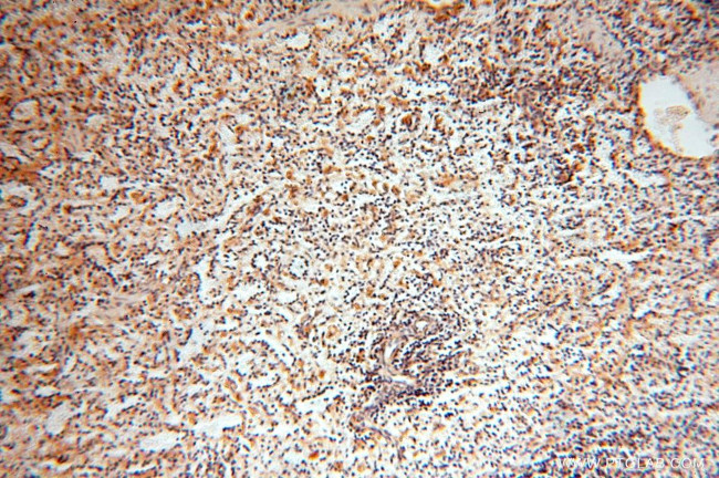 HSD17B8 Antibody in Immunohistochemistry (Paraffin) (IHC (P))