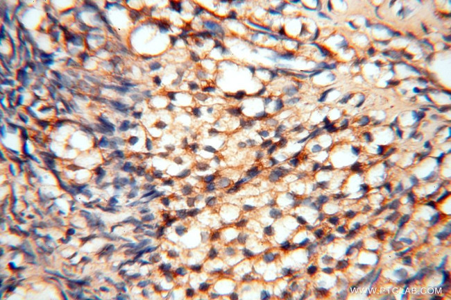 HSD17B8 Antibody in Immunohistochemistry (Paraffin) (IHC (P))