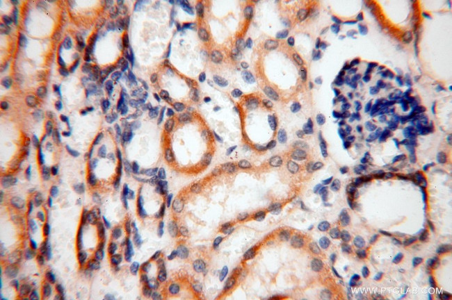 HSD17B8 Antibody in Immunohistochemistry (Paraffin) (IHC (P))