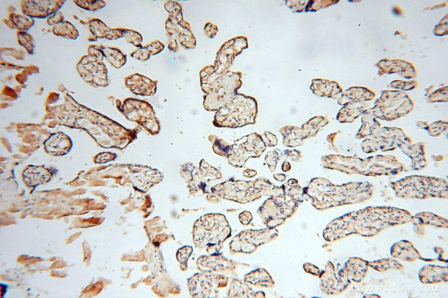 HSD17B8 Antibody in Immunohistochemistry (Paraffin) (IHC (P))