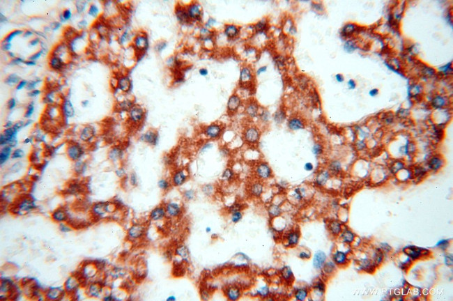 HSD17B8 Antibody in Immunohistochemistry (Paraffin) (IHC (P))