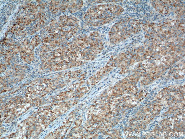 PCK1 Antibody in Immunohistochemistry (Paraffin) (IHC (P))