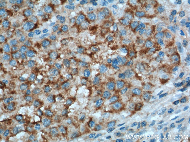 PCK1 Antibody in Immunohistochemistry (Paraffin) (IHC (P))