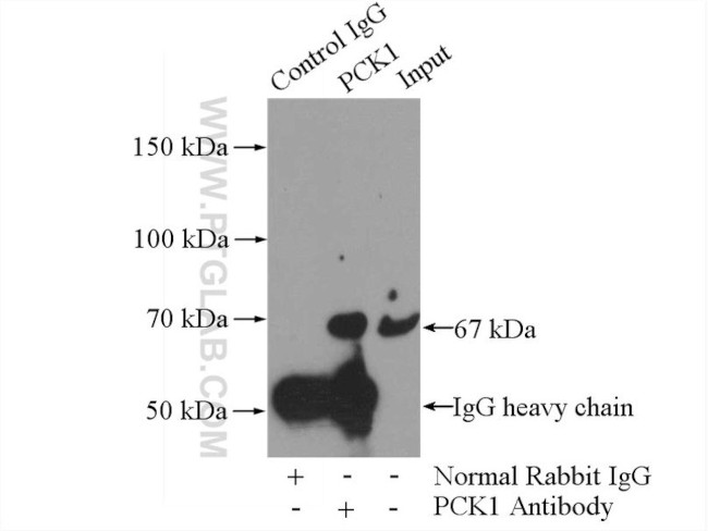 PCK1 Antibody in Immunoprecipitation (IP)