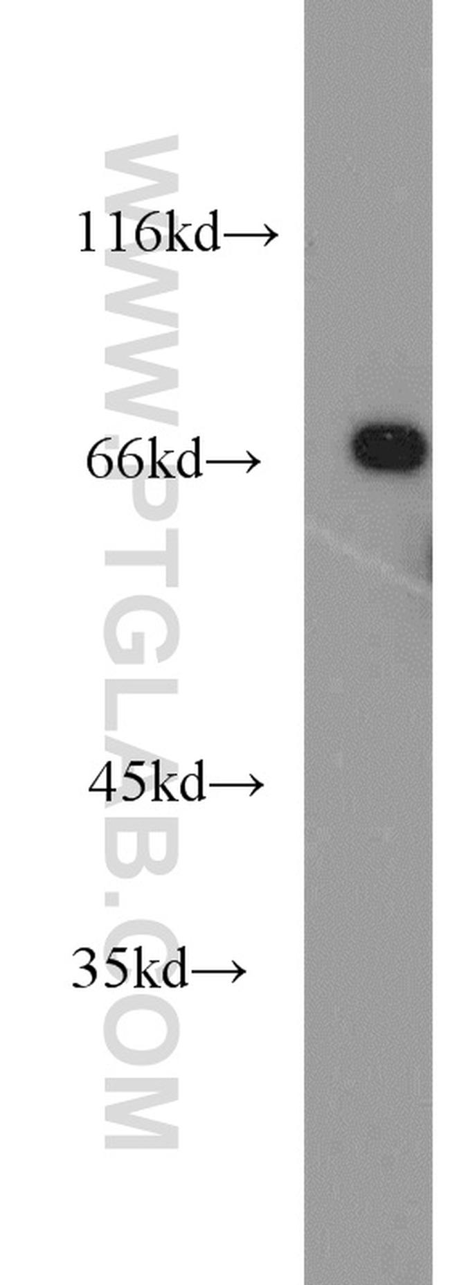 PCK1 Antibody in Western Blot (WB)