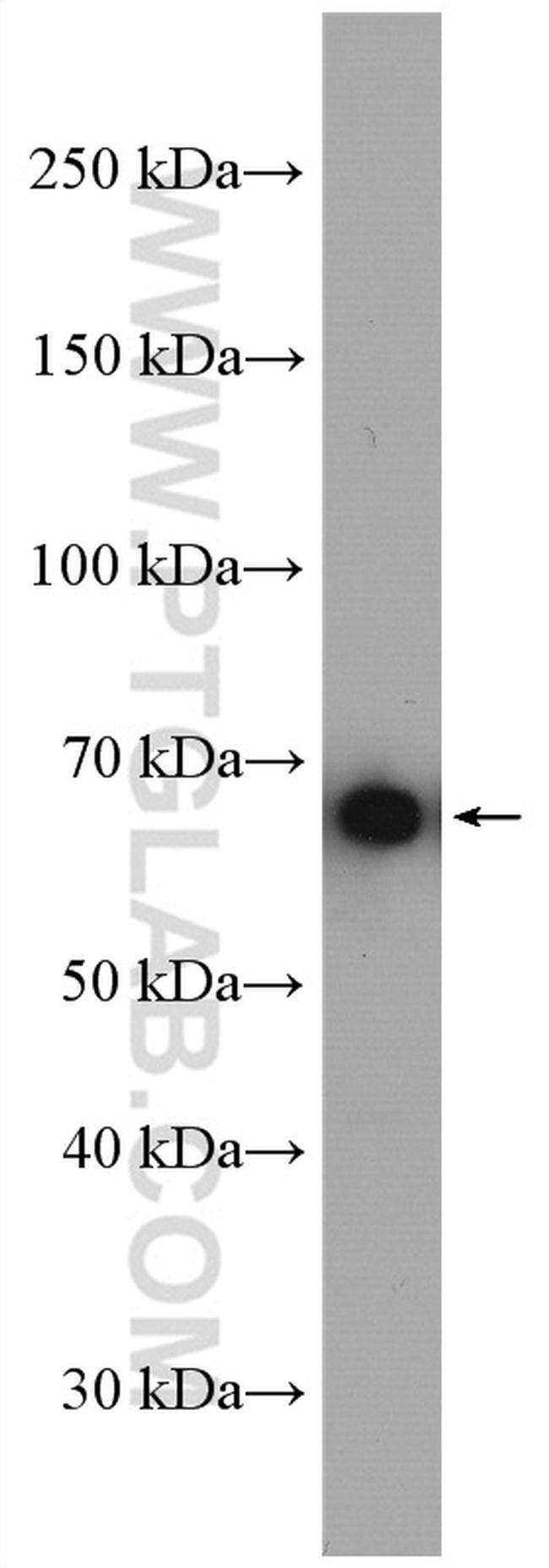 PCK1 Antibody in Western Blot (WB)