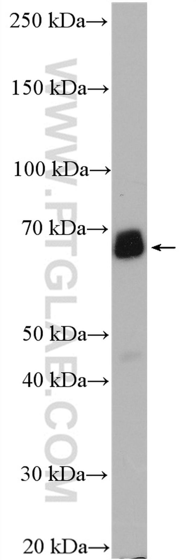 PCK1 Antibody in Western Blot (WB)