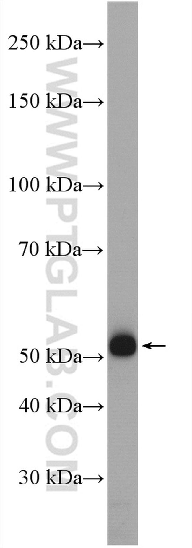 RCC2 Antibody in Western Blot (WB)