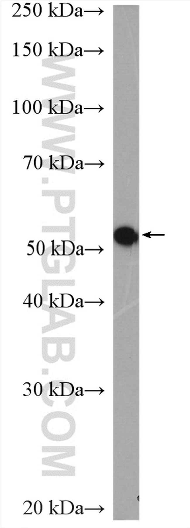 RCC2 Antibody in Western Blot (WB)