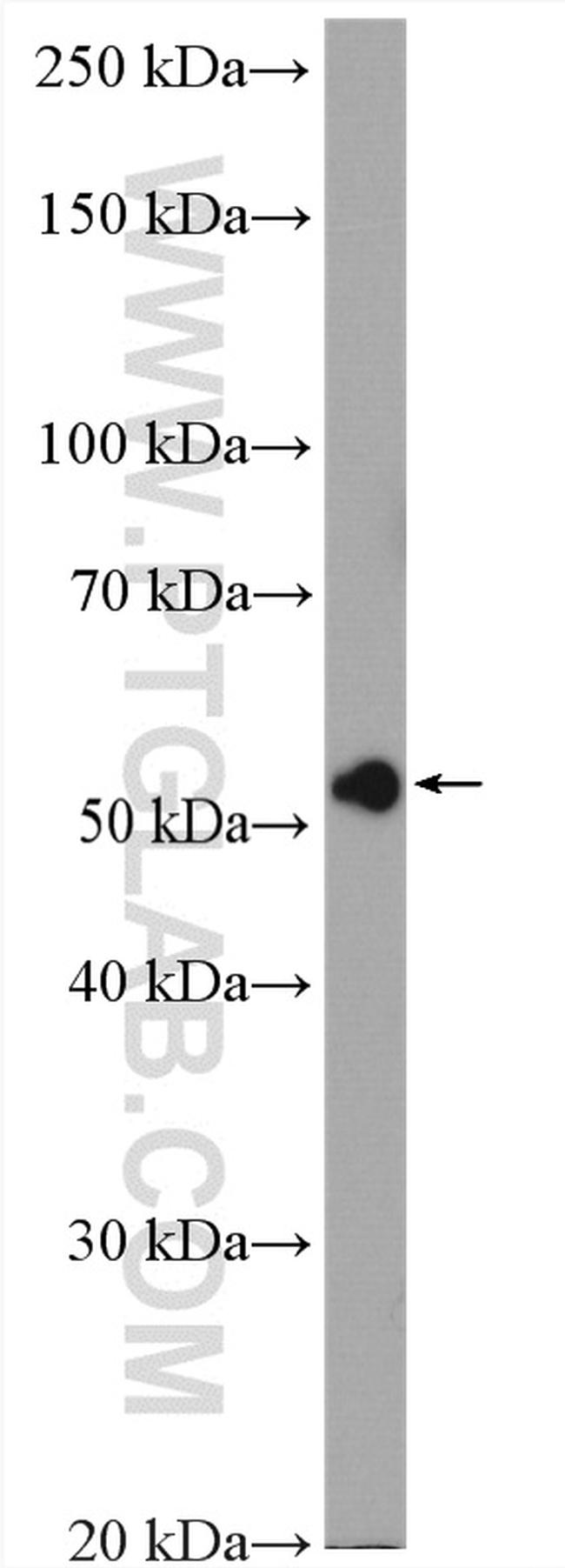 RCC2 Antibody in Western Blot (WB)