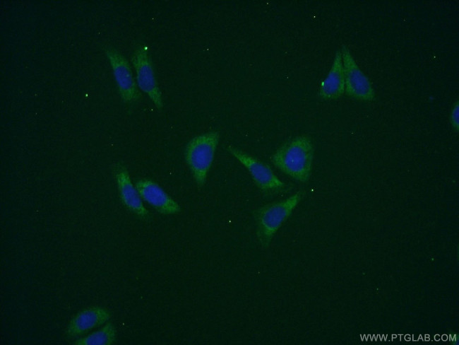 GPT2 Antibody in Immunocytochemistry (ICC/IF)