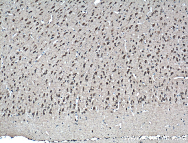 GPT2 Antibody in Immunohistochemistry (Paraffin) (IHC (P))