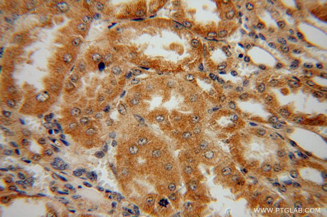 GPT2 Antibody in Immunohistochemistry (Paraffin) (IHC (P))