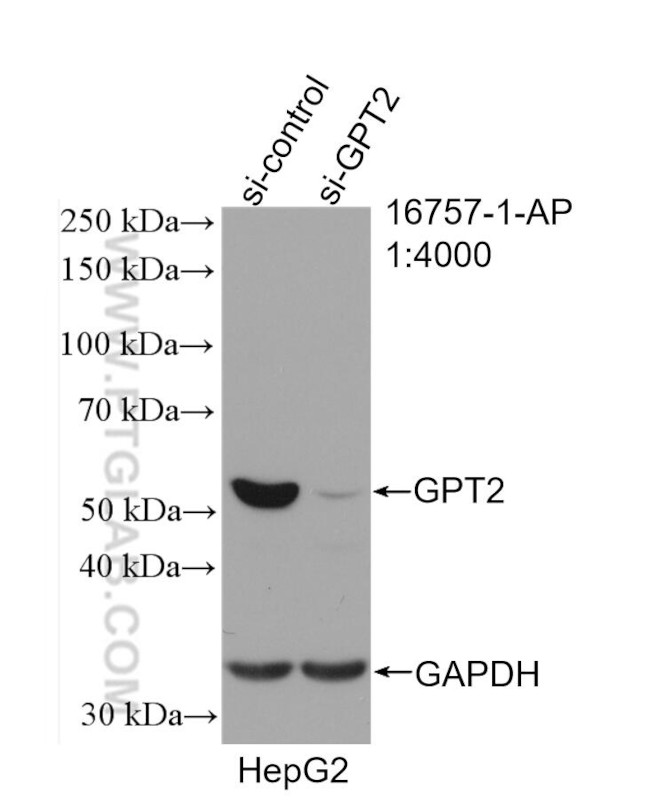 GPT2 Antibody in Western Blot (WB)