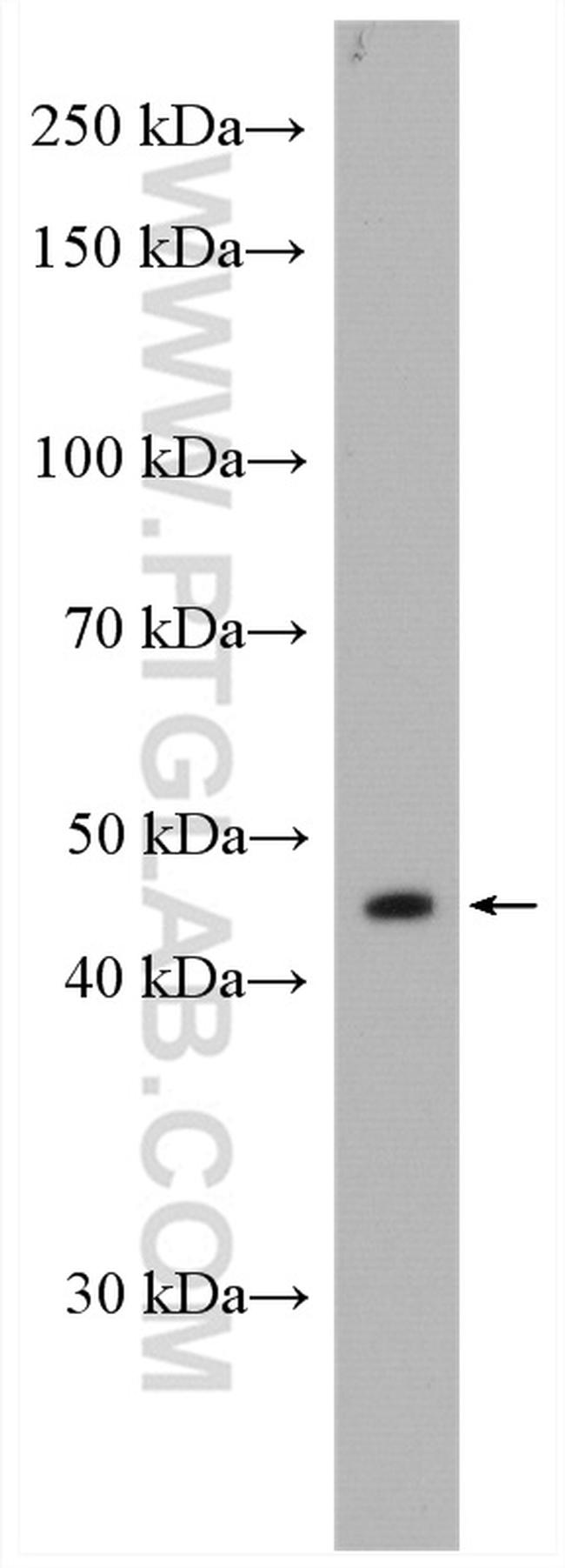 GPT2 Antibody in Western Blot (WB)