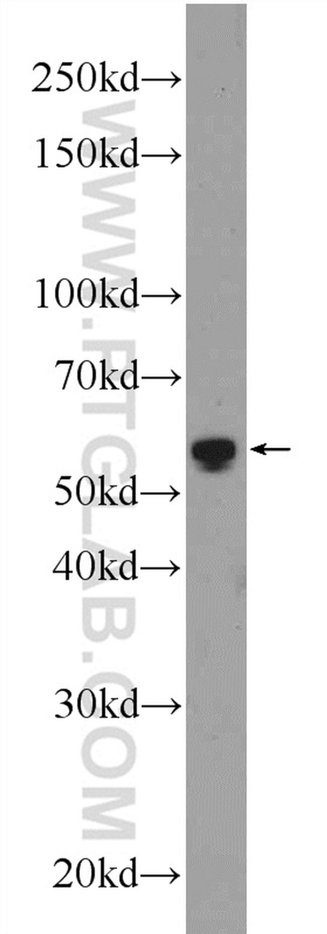 GPT2 Antibody in Western Blot (WB)