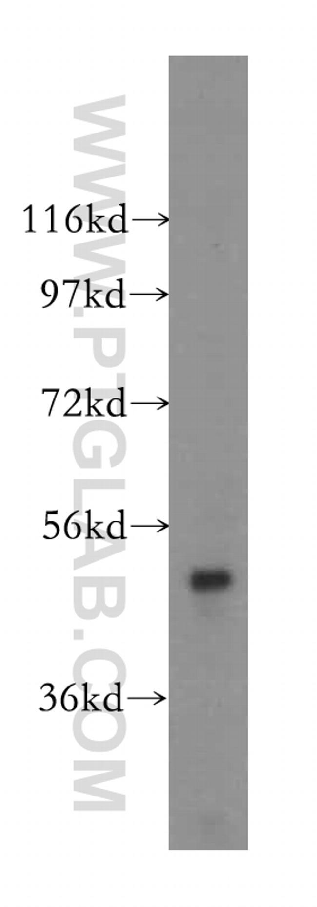 AGPAT6 Antibody in Western Blot (WB)