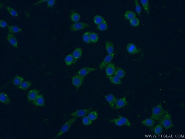 IL 1 alpha Antibody in Immunocytochemistry (ICC/IF)