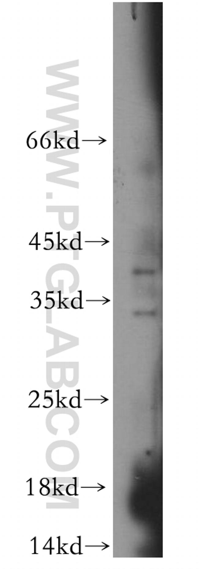 IL 1 alpha Antibody in Western Blot (WB)