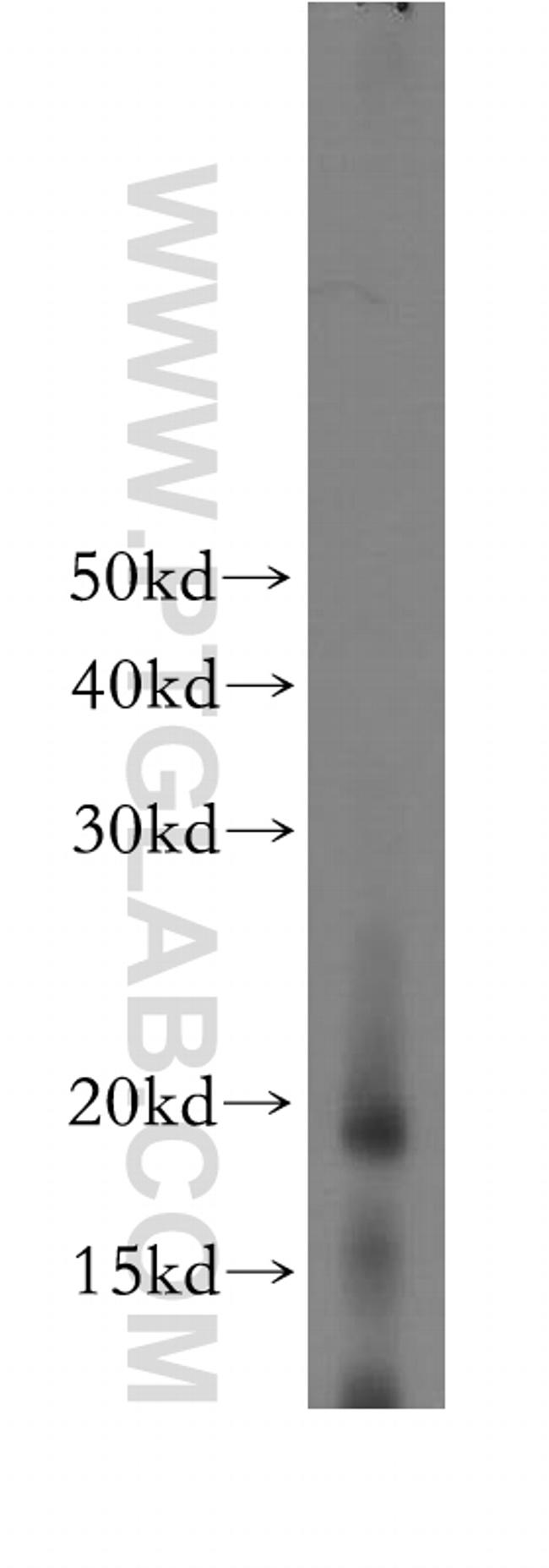 IL 1 alpha Antibody in Western Blot (WB)