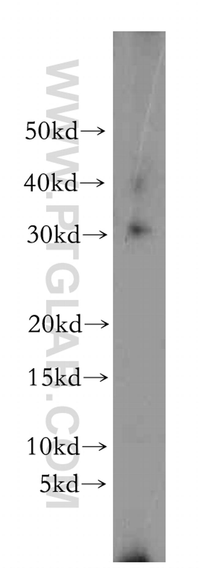 IL 1 alpha Antibody in Western Blot (WB)