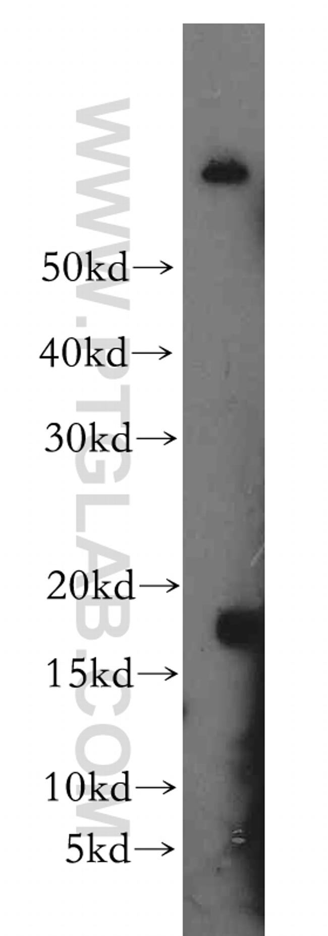 IL 1 alpha Antibody in Western Blot (WB)