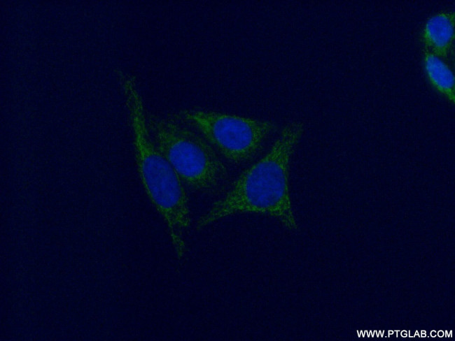 GSTM4 Antibody in Immunocytochemistry (ICC/IF)