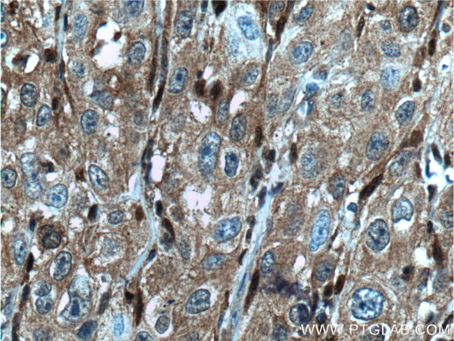 GSTM4 Antibody in Immunohistochemistry (Paraffin) (IHC (P))