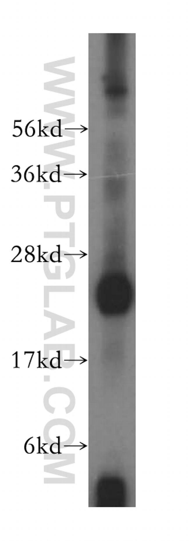 GSTM4 Antibody in Western Blot (WB)