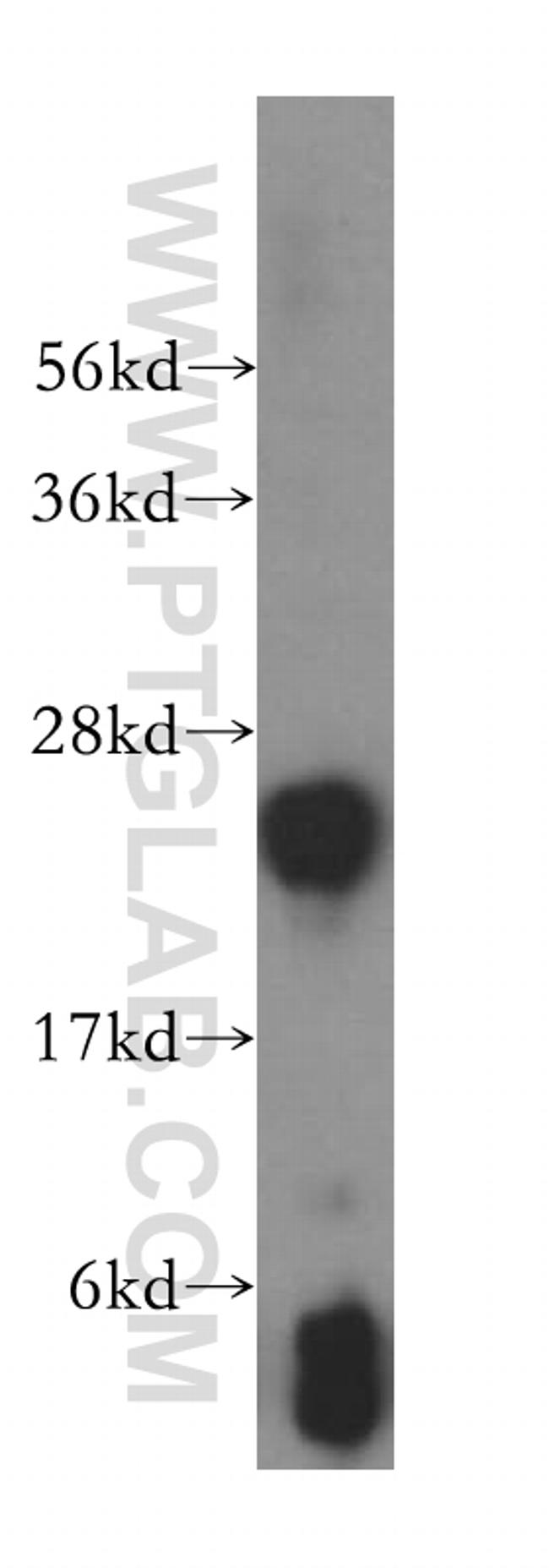 GSTM4 Antibody in Western Blot (WB)