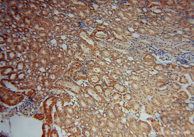 SCUBE3 Antibody in Immunohistochemistry (Paraffin) (IHC (P))